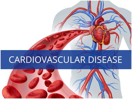 Cardiovascular Disease